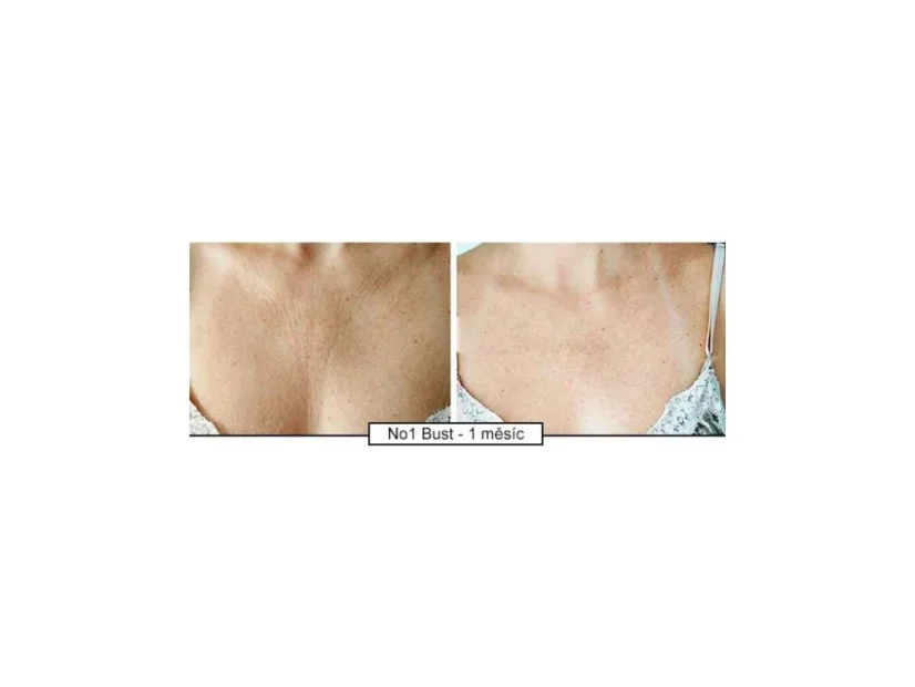 Krém na omlazení dekoltu Intense Décollete 120ml