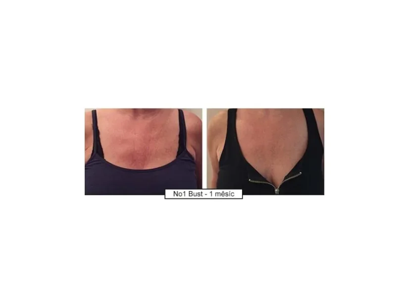 Krém na omlazení dekoltu Intense Décollete 120ml