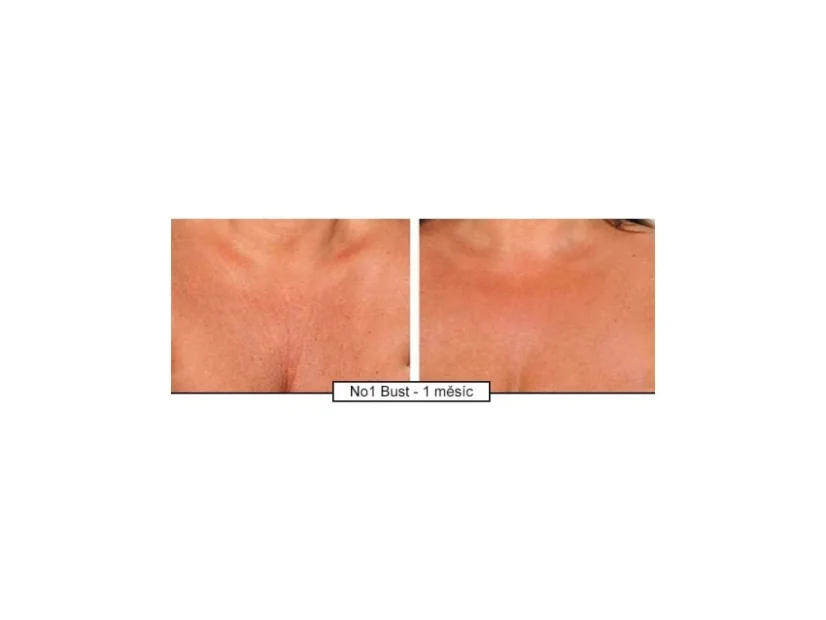 Krém na omlazení dekoltu Intense Décollete 120ml